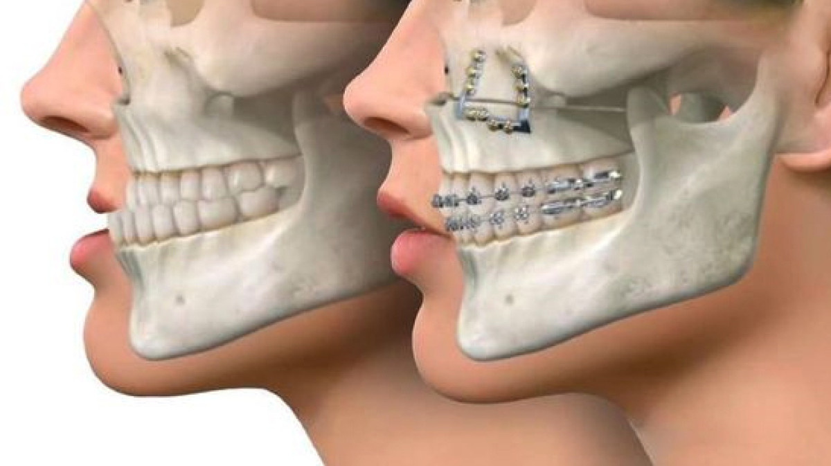 Ağız və üz-çənə cərrahiyyəsi