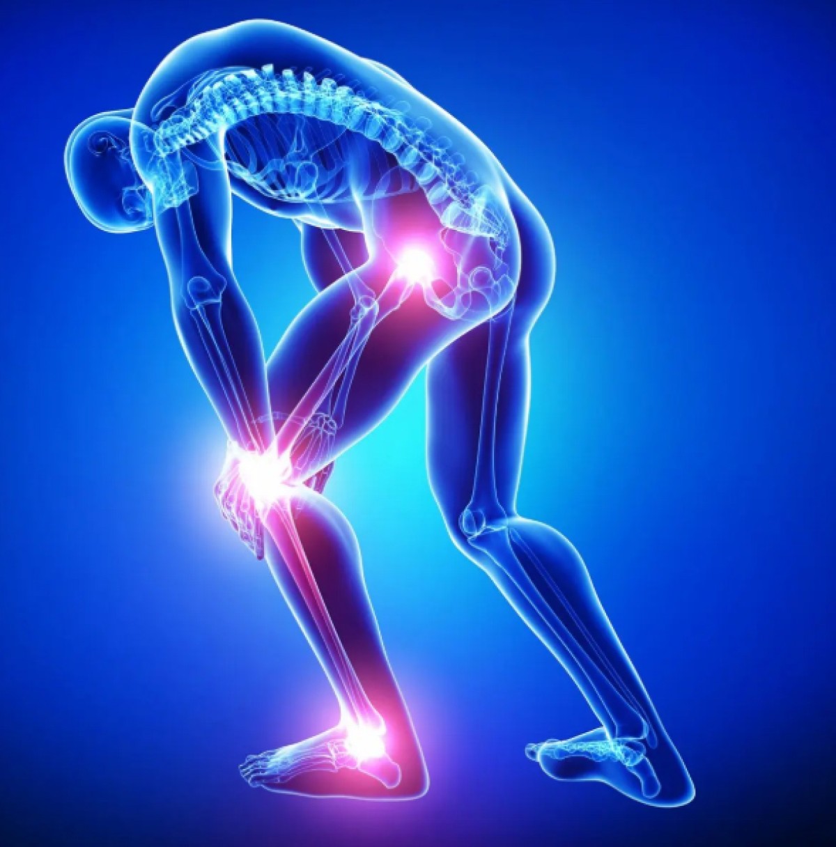 D vitamini çatışmazlığı