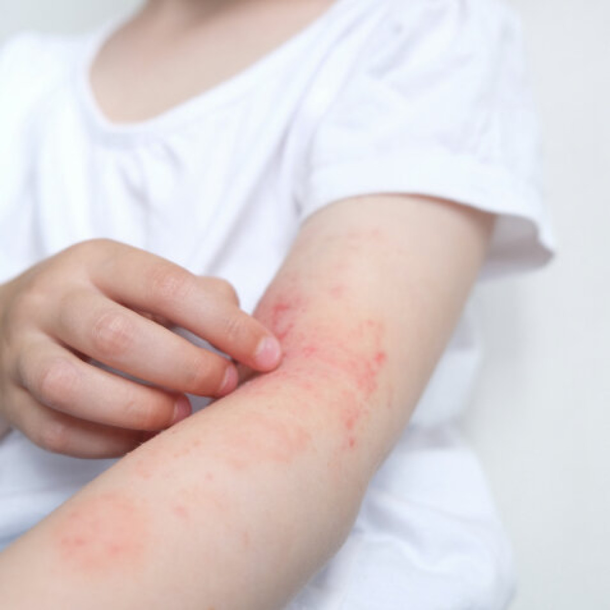 Dəri xəstəlikləri