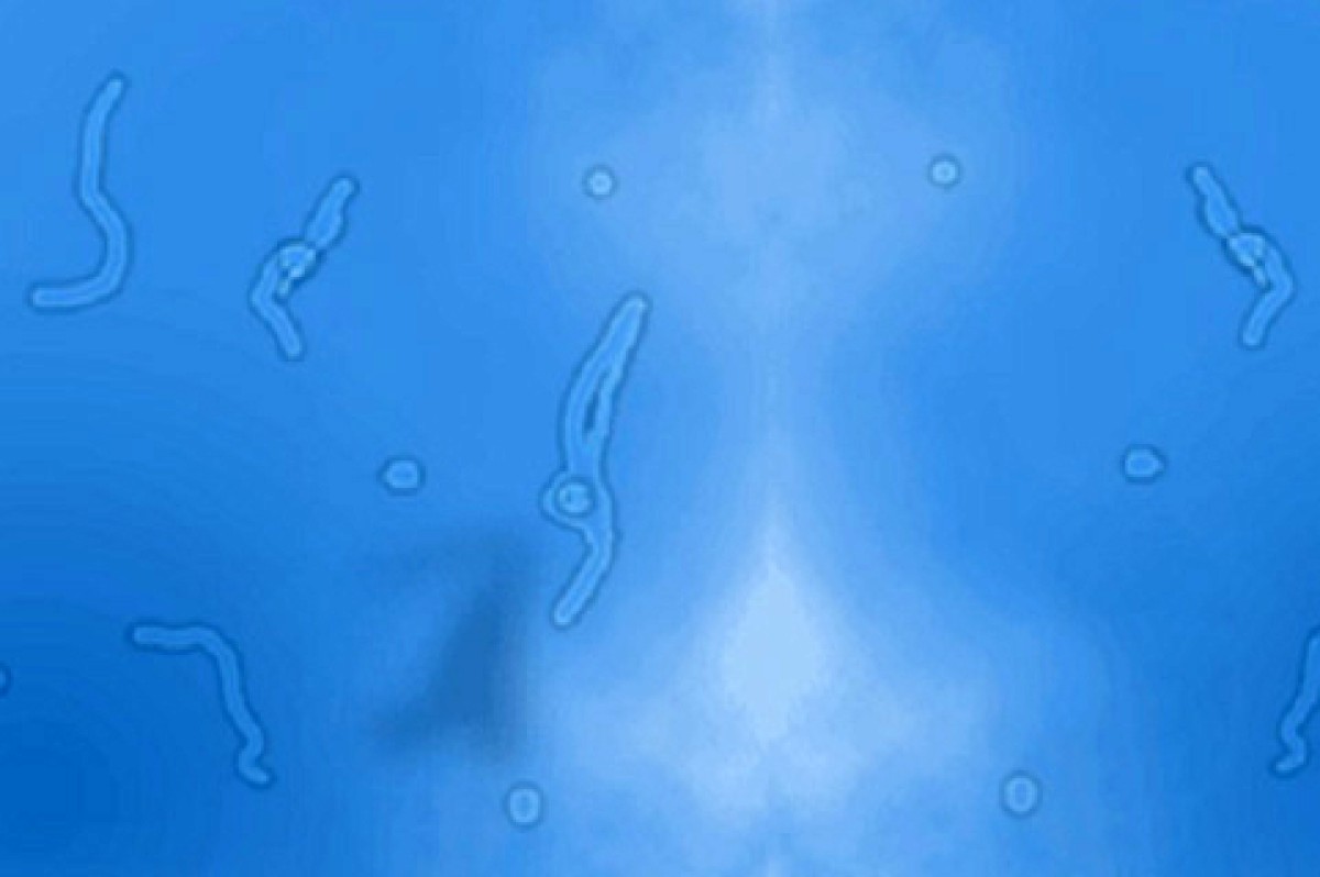 Gözlər qarşısında "ulduzlar"